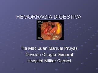 HEMORRAGIA DIGESTIVA




 Tte Med Juan Manuel Pruyas
   División Cirugía General
    Hospital Militar Central
 