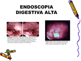 ENDOSCOPIA
DIGESTIVA ALTA
 