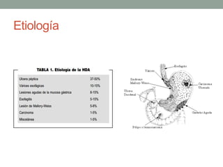 Etiología
 