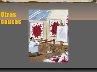 Otras
causas
 