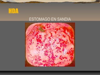 HDA
ESTOMAGO EN SANDIA
 