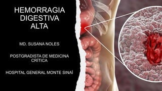 HEMORRAGIA
DIGESTIVA
ALTA
MD. SUSANA NOLES
POSTGRADISTA DE MEDICINA
CRÍTICA
HOSPITAL GENERAL MONTE SINAÍ
 