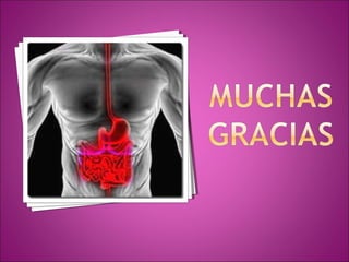 Hemorragia digestiva alta 2013