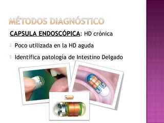 CAPSULA ENDOSCÓPICACAPSULA ENDOSCÓPICA: HD crónica
 Poco utilizada en la HD aguda
 Identifica patología de Intestino Delgado
 