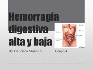 Hemorragia
digestiva
alta y baja
By Francisco Molina V Grupo 4
 