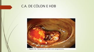 C.A. DE CÓLON E HDB
 