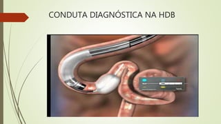 CONDUTA DIAGNÓSTICA NA HDB
 