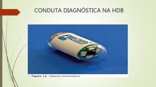 CONDUTA DIAGNÓSTICA NA HDB
 