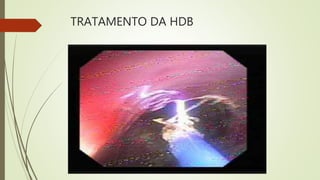 TRATAMENTO DA HDB
 
