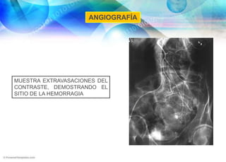 EPIDEMIOLOGÍAMORTALIDAD CERCANA 23% EN LAS SEVERAS+ FREC EN EL VARON QUE EN LA MUJERCAUSAS ORIGEN PRINCIPALMENTE COLÓNICO (80%)SU INCIDENCIA AUMENTA CON LA EDADES DE 3-5 VECES + FREC QUE LA HDAMENOR REPERCUSIÓN HEMODINÁMICA  COMPARADA CON LA HDASUELE TENER UN CURSO MENOS GRAVECERCA DEL 80% CESAN ESPONTÁNEAMENTE