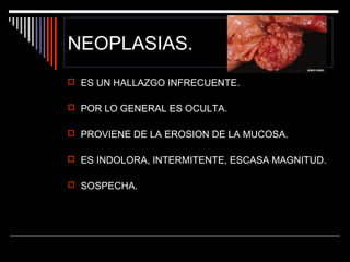 NEOPLASIAS.
 ES UN HALLAZGO INFRECUENTE.
 POR LO GENERAL ES OCULTA.
 PROVIENE DE LA EROSION DE LA MUCOSA.
 ES INDOLORA, INTERMITENTE, ESCASA MAGNITUD.
 SOSPECHA.

 