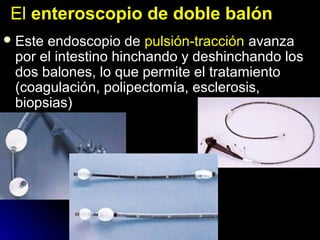 ElEl enteroscopio de doble balónenteroscopio de doble balón
 Este endoscopio deEste endoscopio de pulsión-tracciónpulsión-tracción avanzaavanza
por el intestino hinchando y deshinchando lospor el intestino hinchando y deshinchando los
dos balones, lo que permite el tratamientodos balones, lo que permite el tratamiento
(coagulación, polipectomía, esclerosis,(coagulación, polipectomía, esclerosis,
biopsias)biopsias)
 