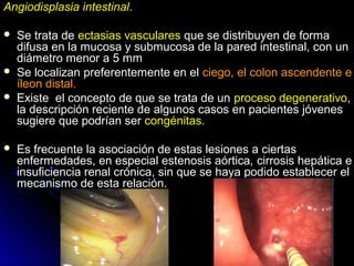 Angiodisplasia intestinalAngiodisplasia intestinal..
 Se trata deSe trata de ectasias vascularesectasias vasculares que se distribuyen de formaque se distribuyen de forma
difusa en la mucosa y submucosa de la pared intestinal, con undifusa en la mucosa y submucosa de la pared intestinal, con un
diámetro menor a 5 mmdiámetro menor a 5 mm
 Se localizan preferentemente en elSe localizan preferentemente en el ciego, el colon ascendente eciego, el colon ascendente e
íleon distal.íleon distal.
 Existe el concepto de que se trata de unExiste el concepto de que se trata de un proceso degenerativoproceso degenerativo,,
la descripción reciente de algunos casos en pacientes jóvenesla descripción reciente de algunos casos en pacientes jóvenes
sugiere que podrían sersugiere que podrían ser congénitas.congénitas.
 Es frecuente la asociación de estas lesiones a ciertasEs frecuente la asociación de estas lesiones a ciertas
enfermedades, en especial estenosis aórticaenfermedades, en especial estenosis aórtica,, cirrosis hepática ecirrosis hepática e
insuficiencia renal crónica, sin que se haya podido establecer elinsuficiencia renal crónica, sin que se haya podido establecer el
mecanismo de esta relación.mecanismo de esta relación.
 