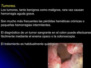 TumoresTumores..
Los tumores, tanto benignos como malignos, rara vez causanLos tumores, tanto benignos como malignos, rara vez causan
hemorragia aguda grave.hemorragia aguda grave.
Son mucho más frecuentes las pérdidas hemáticas crónicas oSon mucho más frecuentes las pérdidas hemáticas crónicas o
pequeñas hemorragias intermitentes.pequeñas hemorragias intermitentes.
El diagnóstico de un tumor sangrante en el colon puede efectuarseEl diagnóstico de un tumor sangrante en el colon puede efectuarse
fácilmente mediante el enema opaco o la colonoscopia.fácilmente mediante el enema opaco o la colonoscopia.
El tratamiento es habitualmente quirúrgico.El tratamiento es habitualmente quirúrgico.
 