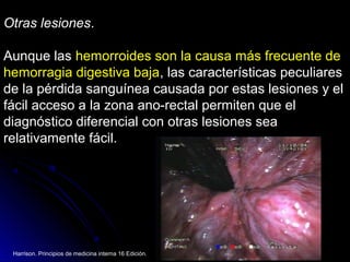 Otras lesionesOtras lesiones..
Aunque lasAunque las hemorroides son la causa más frecuente dehemorroides son la causa más frecuente de
hemorragia digestiva bajahemorragia digestiva baja, las características peculiares, las características peculiares
de la pérdida sanguínea causada por estas lesiones y elde la pérdida sanguínea causada por estas lesiones y el
fácil acceso a la zona ano-rectal permiten que elfácil acceso a la zona ano-rectal permiten que el
diagnóstico diferencial con otras lesiones seadiagnóstico diferencial con otras lesiones sea
relativamente fácil.relativamente fácil.
Harrison. Principios de medicina interna 16 Edición.
 