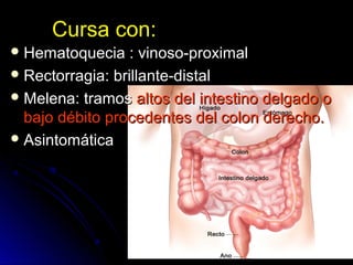 Cursa con:Cursa con:
 Hematoquecia : vinoso-proximalHematoquecia : vinoso-proximal
 Rectorragia: brillante-distalRectorragia: brillante-distal
 Melena: tramosMelena: tramos altos del intestino delgado oaltos del intestino delgado o
bajo débito procedentes del colon derecho.bajo débito procedentes del colon derecho.
 AsintomáticaAsintomática
 
