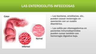 LAS ENTEROCOLITIS INFECCIOSAS
– Las bacilares, amebianas, etc.,
pueden causar rectorragia en
asociación con un cuadro
disentérico.
– Las colitis por citomegalovirus en
pacientes inmunodeprimidos
pueden cursar también con
hemorragia digestiva baja.
 