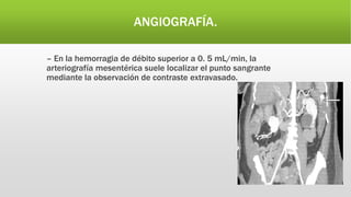 ANGIOGRAFÍA.
– En la hemorragia de débito superior a 0. 5 mL/min, la
arteriografía mesentérica suele localizar el punto sangrante
mediante la observación de contraste extravasado.
 