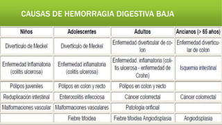 CAUSAS DE HEMORRAGIA DIGESTIVA BAJA
 