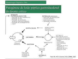 Hemorragia Digestiva Alta

Patogênese da lesão péptica gastroduodenal
do doente crítico




                                   Felix VN, HD no doente crítico (AMIB), 2001
 