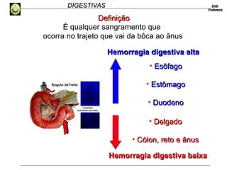 HEMORRAGIAS
DIGESTIVASDIGESTIVAS
Hemorragia digestiva baixaHemorragia digestiva baixa
Hemorragia digestiva altaHemorragia digestiva alta
É qualquer sangramento que
ocorra no trajeto que vai da bôca ao ânus
DefiniçãoDefinição
• EsôfagoEsôfago
• EstômagoEstômago
• DuodenoDuodeno
• DelgadoDelgado
• Cólon, reto e ânusCólon, reto e ânus
Ângulo deTreitz
 
