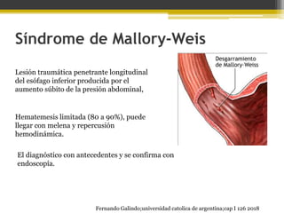 Síndrome de Mallory-Weis
Lesión traumática penetrante longitudinal
del esófago inferior producida por el
aumento súbito de la presión abdominal,
Hematemesis limitada (80 a 90%), puede
llegar con melena y repercusión
hemodinámica.
El diagnóstico con antecedentes y se confirma con
endoscopía.
Fernando Galindo;universidad catolica de argentina;cap I 126 2018
 