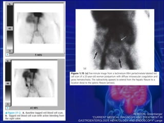 NORTON, Greenberger
“CURRENT MEDICAL DIAGNOSIS AND TREATMENT IN
GASTROENTEROLOGY, HEPATOLOGY AND ENDOSCOPY” Lange
 