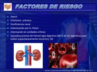  Sepsis
 Síndrome urémico
 Insuficiencia renal
 Colonización por H. Pylori
 Internación en unidades criticas
 Episodios previos de hemorragia digestiva (80 % de las digestivas que
ceden espontáneamente recurren). (4)
Morali A. Gastrointestinal hemorrhages in Adul. Rev Prat 1998; 48: 411-5
 