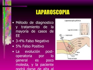 LAPAROSCOPIA Método de diagnostico y tratamiento de la mayoría de casos de EE 3-4% Falso Negativo 5% Falso Positivo La evolución post-operatoria por lo general es poco molesta, y la paciente podrá darse de alta al segundo o tercer día. 