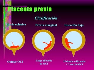 Placenta previa Clasificación Previa oclusiva Previa marginal Inserción baja Ocluye OCI Llega al borde de OCI Ubicada a distancia < 2 cm. de OCI 
