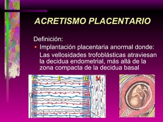 Definición: Implantación placentaria anormal donde: Las vellosidades trofoblásticas atraviesan la decidua endometrial, más allá de la zona compacta de la decidua basal . ACRETISMO PLACENTARIO C E B M 
