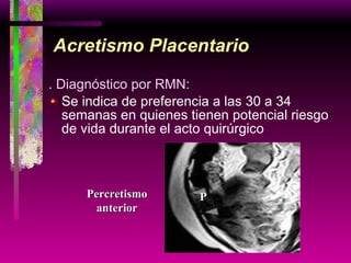 Acretismo Placentario .  Diagnóstico por RMN: Se indica de preferencia a las 30 a 34 semanas en quienes tienen potencial riesgo de vida durante el acto quirúrgico Percretismo anterior P 
