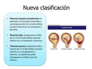 Nueva clasificación
• Placenta situada normalmente: la
placenta se encuentra insertada a
una distancia de 3,5 cm del orifi...
