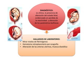 DIAGNÓSTICO:
es clínico, la presencia de
alteración del estado fetal,
evidenciado en perdida de
la reactividad y alteració...