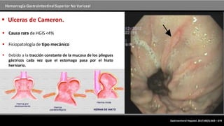 Hemorragia GastrointestinalSuperior No Variceal
 Ulceras de Cameron.
 Causa rara de HGIS <4%
 Fisiopatología de tipo mecánico
 Debido a la tracción constante de la mucosa de los pliegues
gástricos cada vez que el estomago pasa por el hiato
herniario.
Gastroenterol Hepatol. 2017;40(5):363---374
 