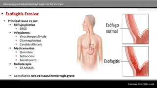 Hemorragia GastrointestinalSuperior No Variceal
Endoscopy 2015; 47(10): a1-a46
 Esofagitis Erosiva:
 Principal causa es por:
 Reflujo gástrico
 ERGE
 Infecciones:
 Virus Herpes Simple
 Citomegalovirus
 Candida Albicans
 Medicamentos:
 Quinidina
 Tetraciclina
 Alendronato
 Radioterapia
 CA MAMA
 La esofagitis rara vez causa hemorragiagrave
 