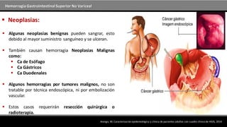 Hemorragia GastrointestinalSuperior No Variceal
 Neoplasias:
 Algunas neoplasias benignas pueden sangrar, esto
debido al mayor suministro sanguíneo y se ulceran.
 También causan hemorragia Neoplasias Malignas
como:
 Ca de Esófago
 Ca Gástricos
 Ca Duodenales
 Algunos hemorragias por tumores malignos, no son
tratable por técnica endoscópica, ni por embolización
vascular.
 Estos casos requerirán resección quirúrgica o
radioterapia.
Arango, M; Caracterización epidemiológica y clínica de pacientes adultos con cuadro clínico de HGIS, 2014
 