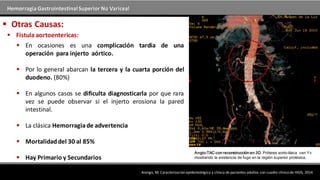 Hemorragia GastrointestinalSuperior No Variceal
 Otras Causas:
 Fistula aortoentericas:
Arango, M; Caracterización epidemiológica y clínica de pacientes adultos con cuadro clínico de HGIS, 2014
 En ocasiones es una complicación tardía de una
operación para injerto aórtico.
 Por lo general abarcan la tercera y la cuarta porción del
duodeno. (80%)
 En algunos casos se dificulta diagnosticarla por que rara
vez se puede observar si el injerto erosiona la pared
intestinal.
 La clásica Hemorragiade advertencia
 Mortalidaddel 30 al 85%
 Hay Primario y Secundarios
Angio-TAC con reconstrucción en 3D. Prótesis aorto-ilíaca «en Y»
mostrando la existencia de fuga en la región superior protésica.
 
