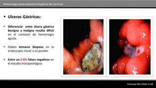 Hemorragia GastrointestinalSuperior No Variceal
Endoscopy 2015; 47(10): a1-a46
 Diferenciar entre úlcera gástrica
benigna y maligna resulta difícil
en el contexto de hemorragia
aguda.
 Deben tomarse biopsias en la
endoscopia inicial si es posible.
 Entre un 2-6% falsos negativos en
el estudio histopatológico
 Ulceras Gástricas:
 
