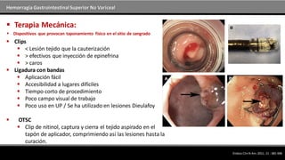 Hemorragia GastrointestinalSuperior No Variceal
 Clips
 < Lesión tejido que la cauterización
 > efectivos que inyección de epinefrina
 > caros
 Ligadura con bandas
 Aplicación fácil
 Accesibilidad a lugares difíciles
 Tiempo corto de procedimiento
 Poco campo visual de trabajo
 Poco uso en UP / Se ha utilizado en lesiones Dieulafoy
 OTSC
 Clip de nitinol, captura y cierra el tejido aspirado en el
tapón de aplicador, comprimiendo así las lesiones hasta la
curación.
 Terapia Mecánica:
 Dispositivos que provocan taponamiento físico en el sitio de sangrado
EndoscClinN Am.2011; 21 : 681-696
 