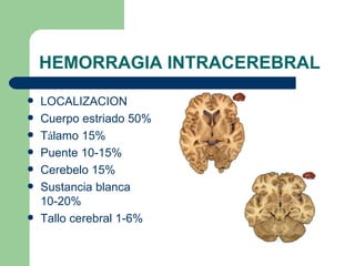 HEMORRAGIA INTRACEREBRAL LOCALIZACION Cuerpo estriado 50% T á lamo 15% Puente 10-15% Cerebelo 15% Sustancia blanca 10-20% Tallo cerebral 1-6% 