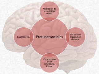 Protuberanciales
Alteración de
la motilidad
ocular.
Cefalea de
instalación
abrupta.
Compromiso
de la
conciencia.
Coma.
Cuadriplejia.
 