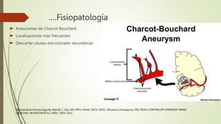 Hemorragia intracerebral.pptx