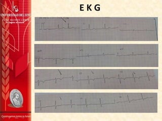 E K G
 