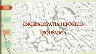 ENCEFALOPATÍA HIPÓXICO-
ISQUÉMICA
 