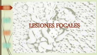LESIONES FOCALES
 
