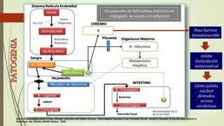 Un aumento de bilirrubina indirecta no
conjugada no unida a la albumina
Pasa barrera
hematoencefáli
ca
Globo pálido,
núcleos
dentados,
vermis
cerebeloso,
hipocampo
Alexis Arzimanoglou,Anne O’Hare, Michael Johnston and Robert Ouvrier, “Neurological Diseases in the Perinatal Period” Aicardi’s Diseases of the Nervous System in
Childhood, 4ta. Edición, British Library, 2018.
Inhibe
fosforilación
mitocondrial
 