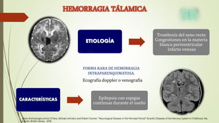 ETIOLOGÍA
Trombosis del seno recto
Congestiones en la materia
blanca periventricular
Infarto venoso
HEMORRAGIA TÁLAMICA
CARACTERÍSTICAS Epilepsia con espigas
continuas durante el sueño
FORMA RARA DE HEMORRAGIA
INTRAPARENQUIMATOSA.
Ecografía doppler o venografía
Alexis Arzimanoglou,Anne O’Hare, Michael Johnston and Robert Ouvrier, “Neurological Diseases in the Perinatal Period” Aicardi’s Diseases of the Nervous System in Childhood, 4ta.
Edición, British Library, 2018.
 