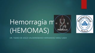 Hemorragia masiva
(HEMOMAS)
DR. TADEO DE JESÚS VALDERRÁBANO HERNANDEZ MRA2 UAEH
 