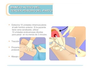 MANEJO ACTIVO DELMANEJO ACTIVO DEL
TERCER PERIODO DEL PARTOTERCER PERIODO DEL PARTO
• Oxitocina 10 unidades intramusculares
al salir hombro anterior. Si la paciente
tiene vena canalizada, utilizar
10 unidades endovenosas diluidas
para pasar en no menos de 3 minutos.
• Tracción controlada del cordón.
• Pinzamiento del cordón según
protocolos.
• Masaje uterino.
 